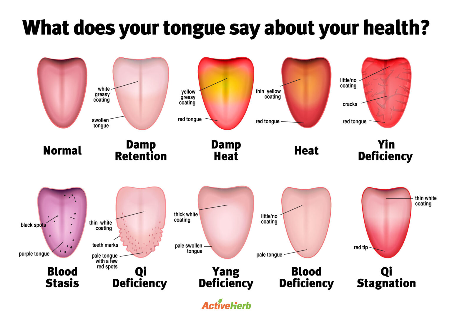 Tongue diagram Activeherb Blog